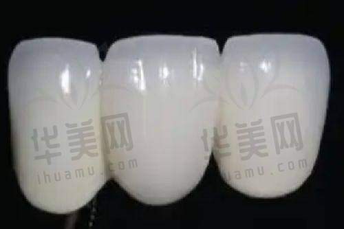 长春爱齿口腔门诊部靠谱吗？10家分店分布广，种牙3580元起，矫正技术也强