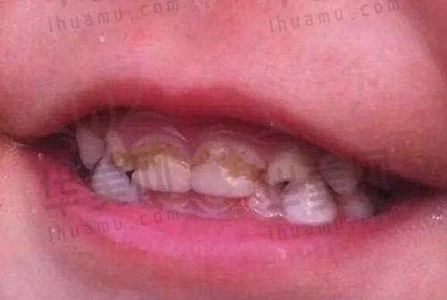 总结
