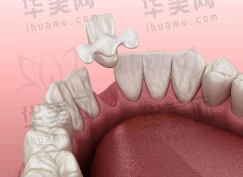 收费价格合理,多种选择满足需求