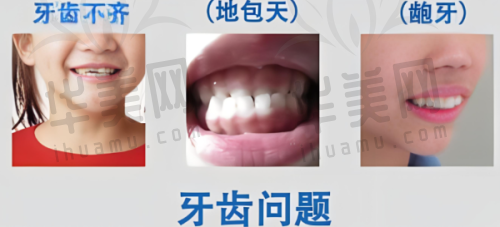 收费标准(北京佳美口腔整体)