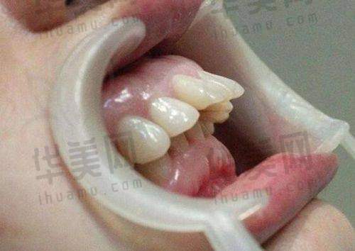 兰州诺贝尔口腔预约方式