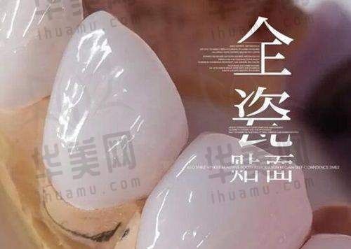 活动价格