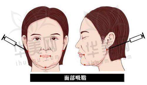 顾客口碑与评价