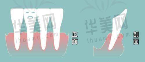 眼部整形优势