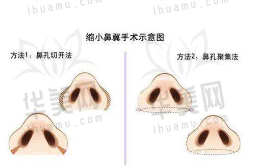 特色诊疗项目——种牙与正畸
