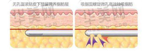 整形修复相关知识