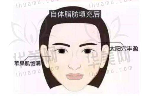 特色项目