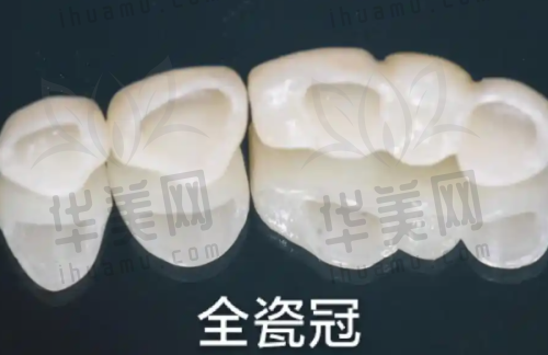 总结
