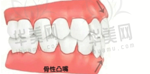 国有私立之辨与收费优势